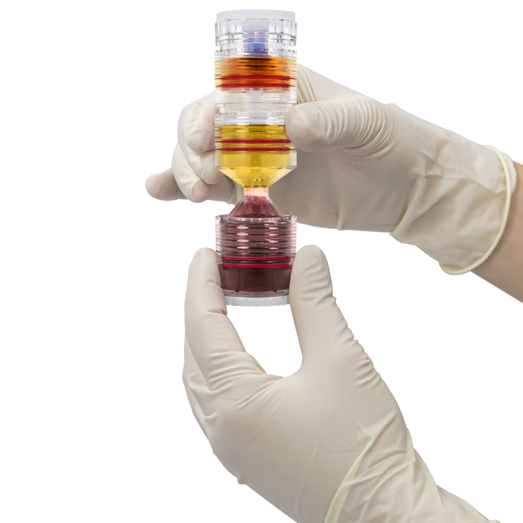 NovaStem Stemcell Treatment